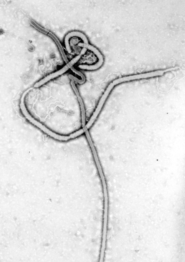 An electron micrograph of an Ebola viral particle, c. 1976.