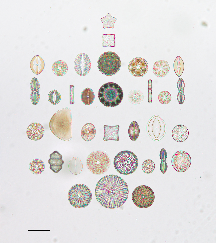 Diatoms Diatoms as seen through an electron microscope.
